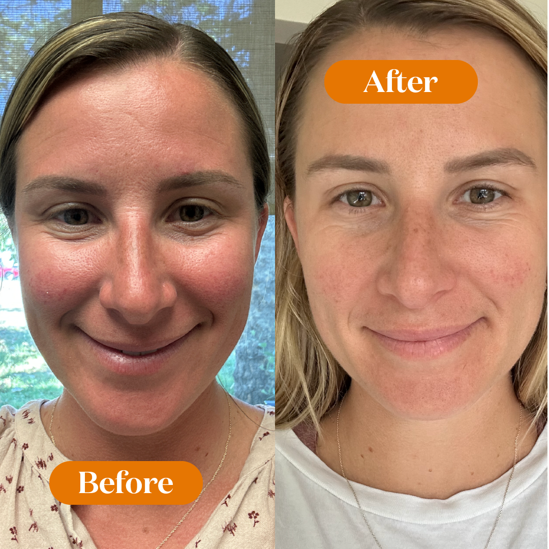 Sensitive Skin Relief Set