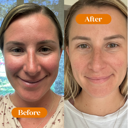 Sensitive Skin Relief Set