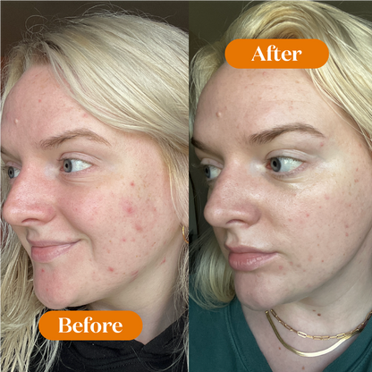 Deep Hydration Face Cream